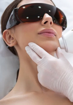 Laserbehandlung Damen